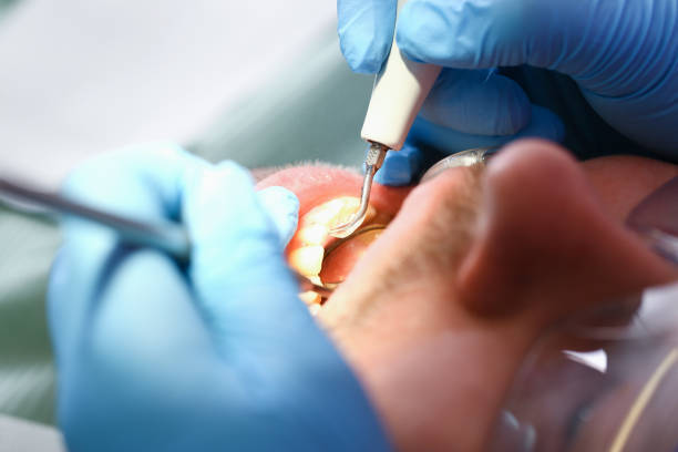 Best Emergency Dental Care for Broken or Chipped Teeth in Baldwyn, MS