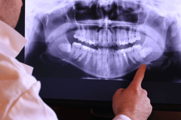 Best Emergency Tooth Extraction in Baldwyn, MS